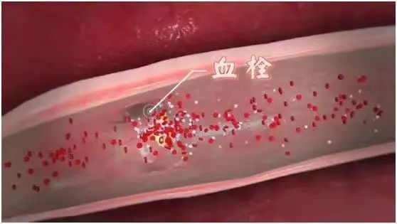 雷竞技RAYBET2种运动被称为“长寿运动”每天坚持这个时长死亡率最低！(图2)