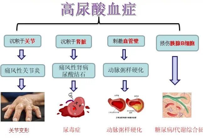 雷竞技RAYBET高尿酸血症也可能是这种原因(图1)