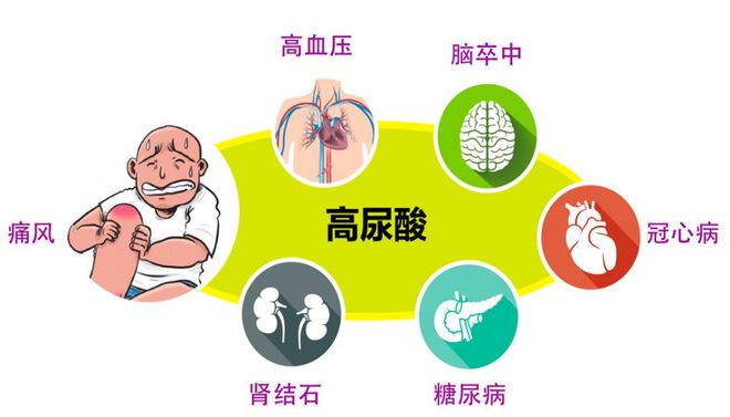 雷竞技RAYBET高尿酸血症也可能是这种原因(图4)